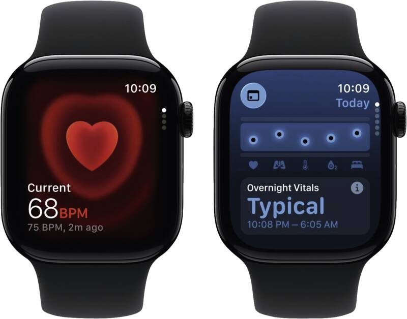 Watch Series 11 GPS + Cellular, 42mm, Alu, Gr. S/M, schwarze