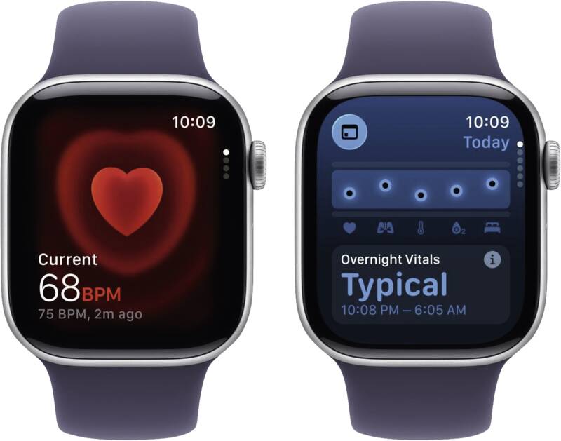 Watch Series 11 GPS + Cellular, 42mm, Alu, Gr. M/L, nebelvio