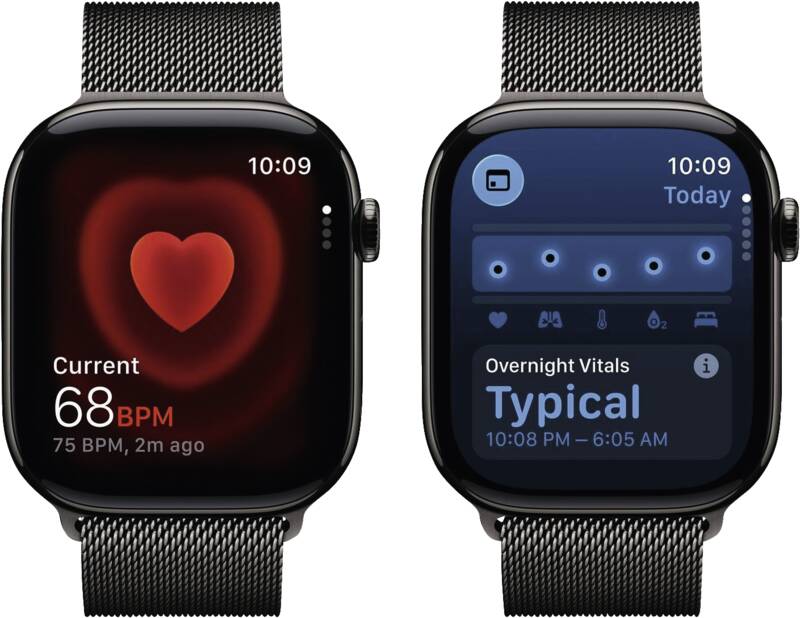 Watch Series 11 GPS + Cellular, 46mm, Titan, Gr. S/M, schief