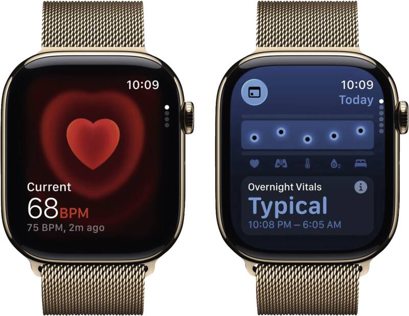 Watch Series 11 GPS + Cellular, 46mm, Titan, Gr. M/L, golden